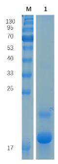 Reducing 12% SDS-PAGE analysis profile of purified Rat IL1RN (CBB stained).